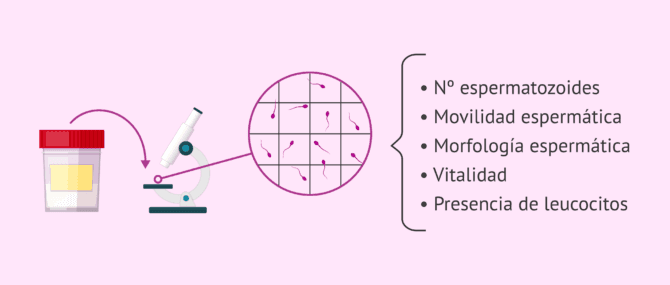 Imagen: Diagnóstico de oligospermia en el seminograma