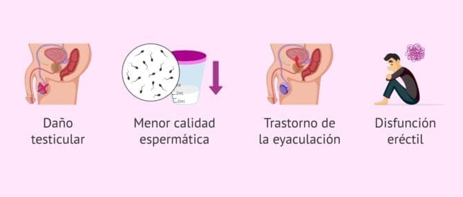 Imagen: Infertilidad masculina