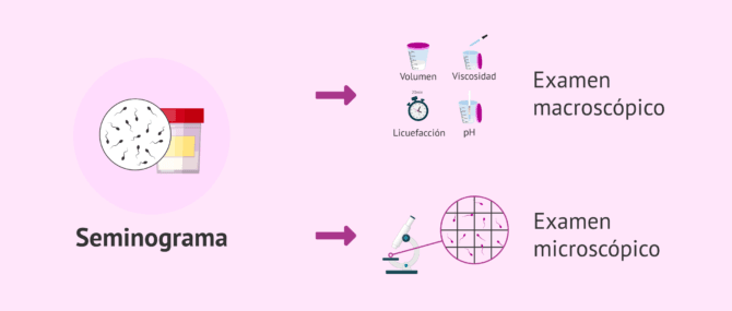 Imagen: Análisis macroscópico y microscópico en el seminograma