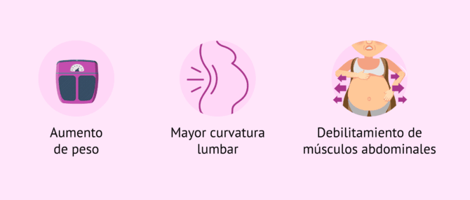 Imagen: ¿Qué produce el dolor de espalda durante el embarazo?