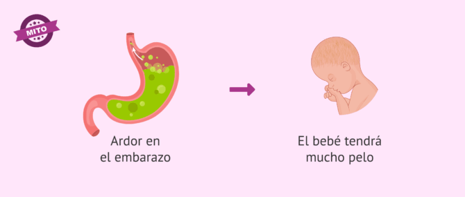 Imagen: Ardor en el embarazo, ¿el bebé tendrá mucho pelo?