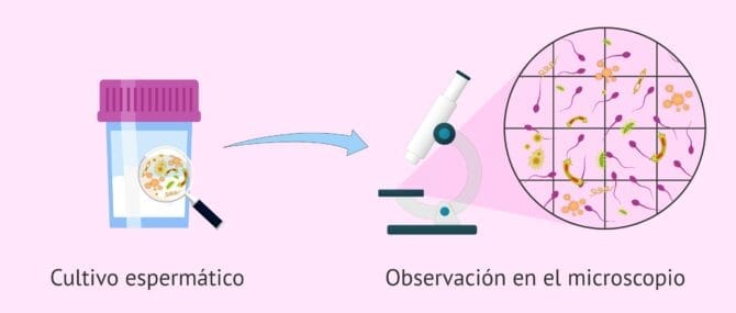 Imagen: Espermocultivo positivo: bacterias en cultivo de semen