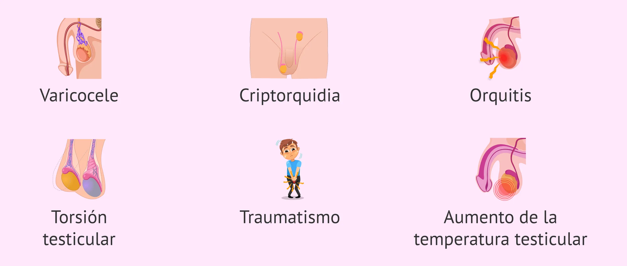 ¿Qué factores testiculares pueden causar azoospermia?