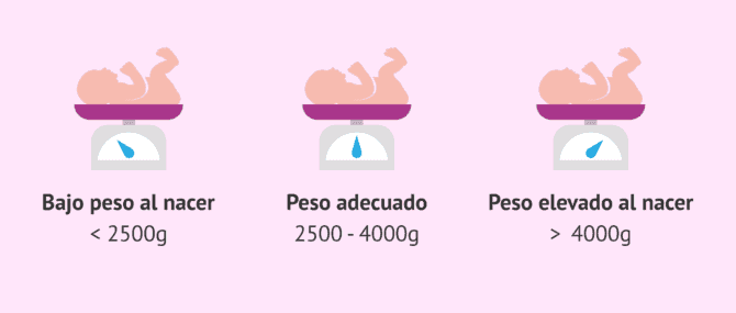 Imagen: Peso del bebé al nacer