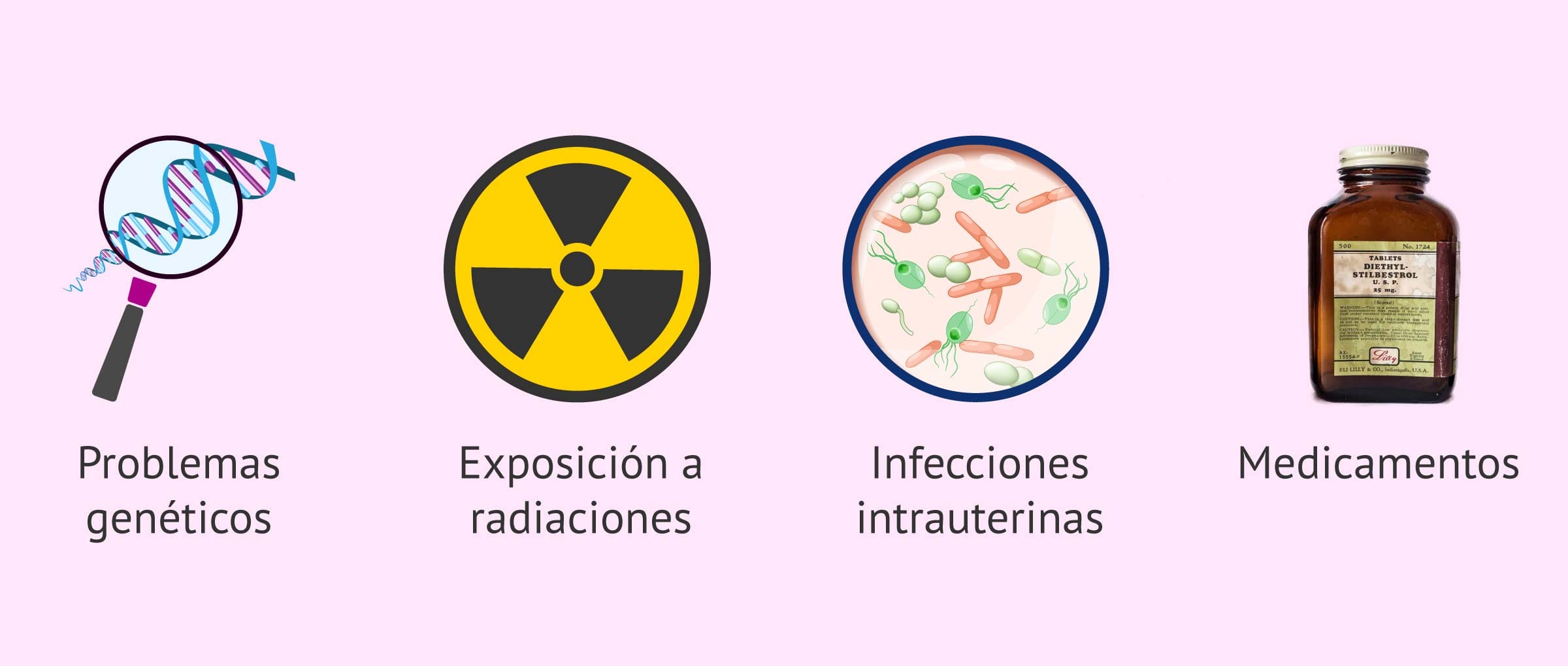 Imagen: Posibles causas de las malformaciones en el útero