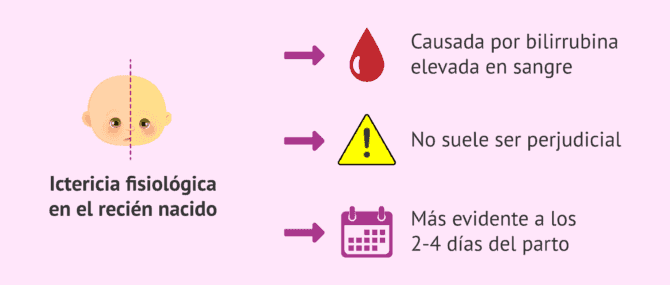 Imagen: ¿Qué es la ictericia en el bebé?