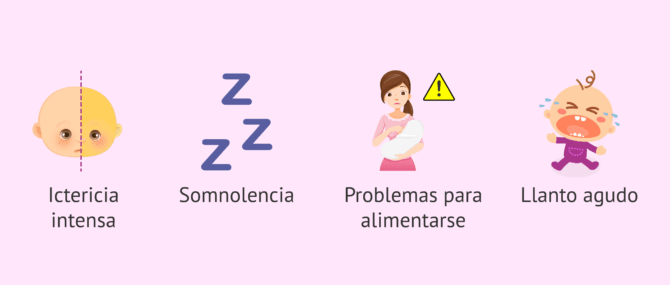 Imagen: ¿Cuándo llevar al médico al bebé con ictericia?