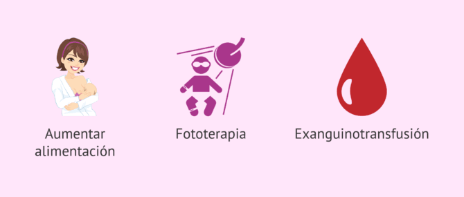 Imagen: Tratamiento de la ictericia neonatal