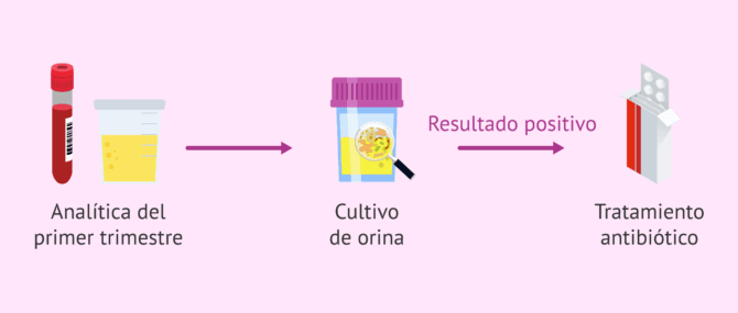 Por que son tan frecuentes las infecciones de orina en el embarazo