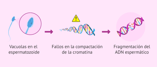 Imagen: ¿Qué puede implicar que un espermatozoide tenga vacuolas?