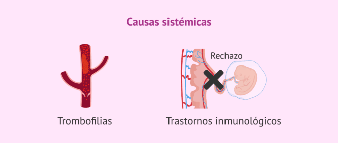 Imagen: Causas sistémicas del fallo de implantación