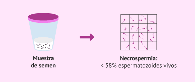 Imagen: Definición de necrozoospermia