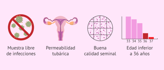 Imagen: Condiciones para la IA