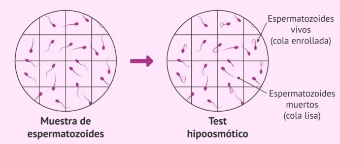 Imagen: Vitalidad espermática