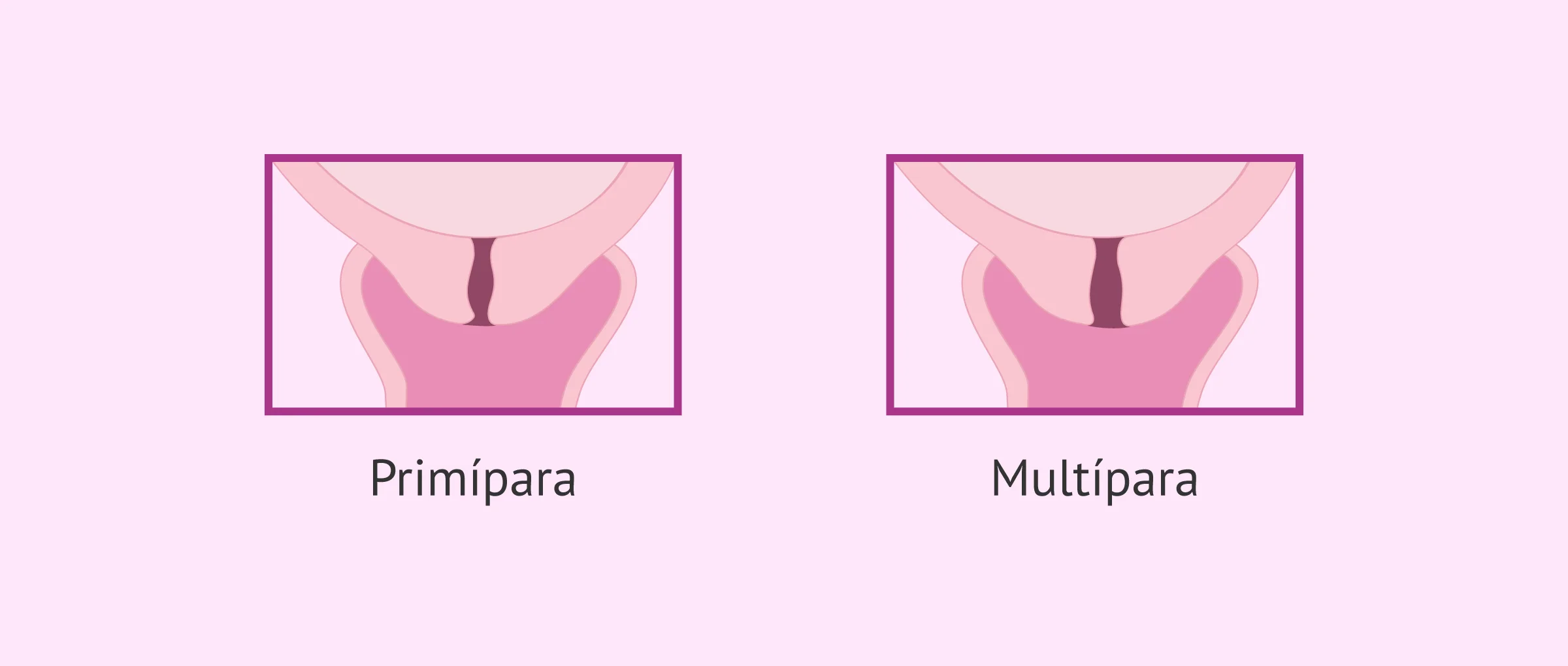 Cambios y posición del cuello uterino durante el embarazo