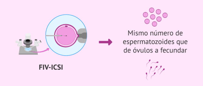 Imagen: ICSI para conseguir el embarazo con oligospermia