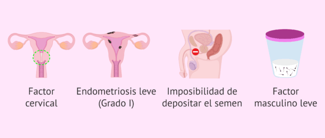 Imagen: ¿Cuándo está indicada la IA conyugal?