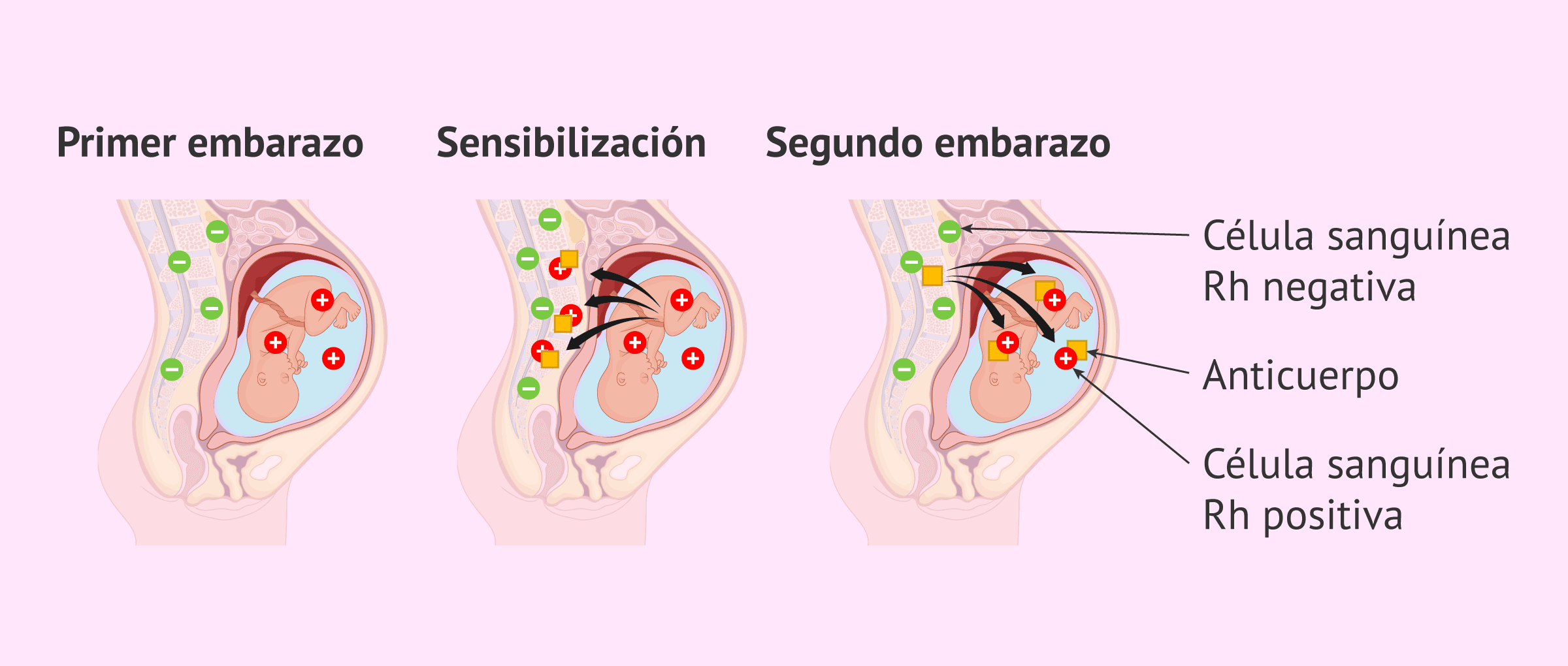 Imagen: ¿Para qué sirve la vacuna anti-D en la semana 28?