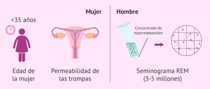 Imagen: IA en varones con oligozoospermia