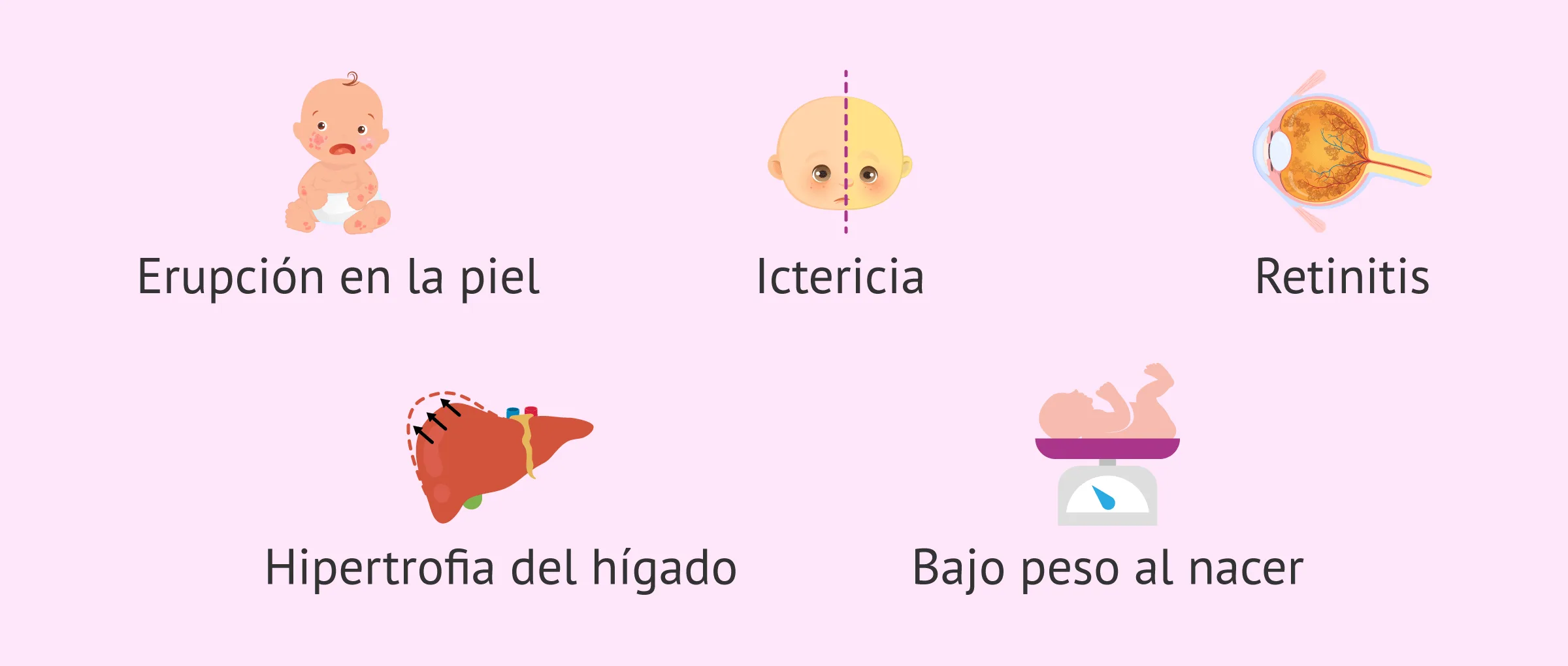 Síntomas de infección por citomegalovirus (CMV)