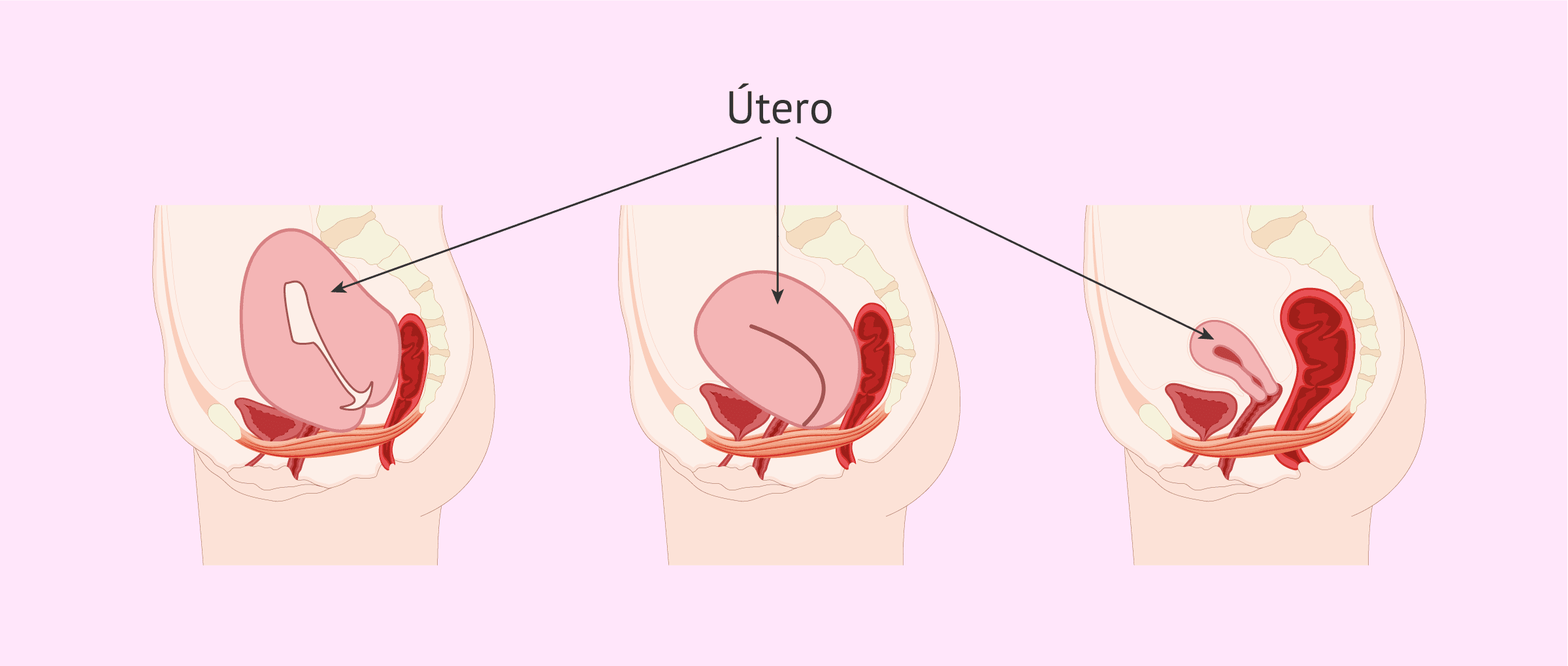 Imagen: ¿Cómo es la involución uterina?