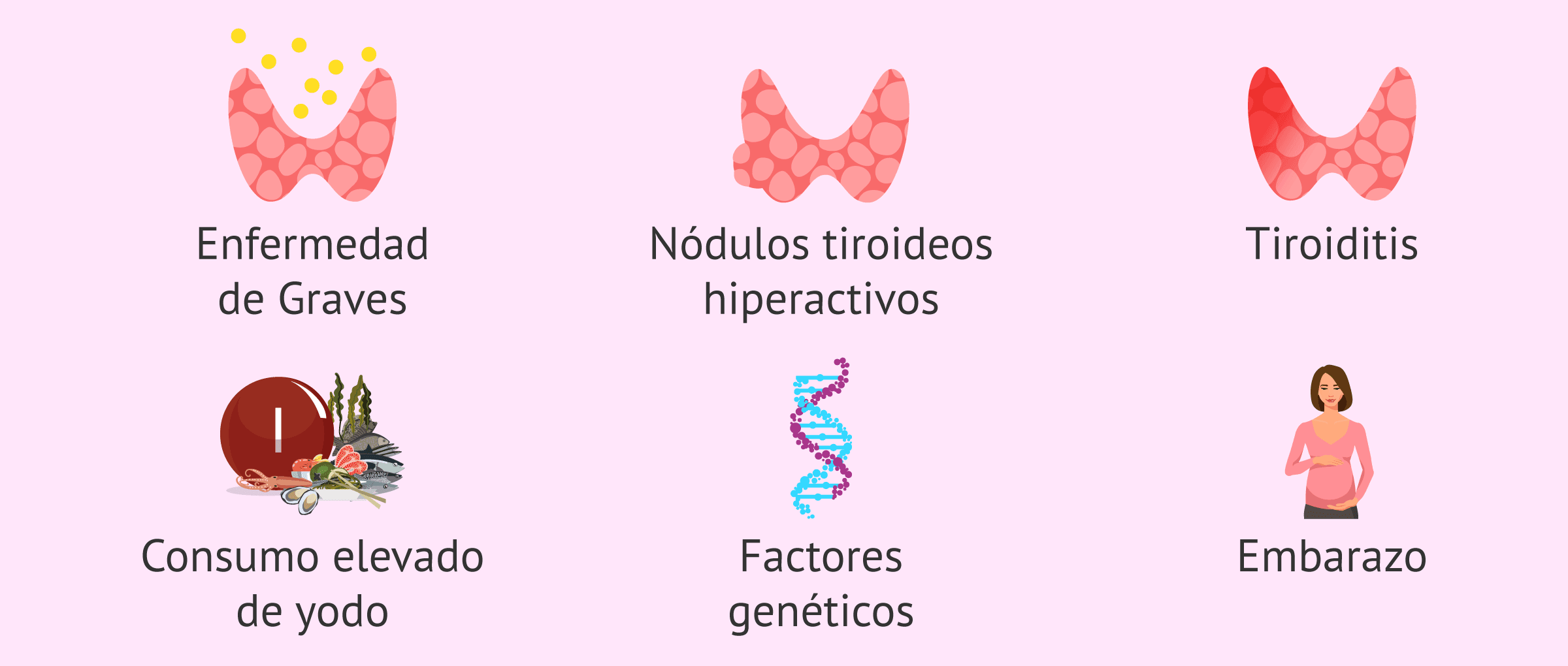 Imagen: Posibles causas del hipertiroidismo