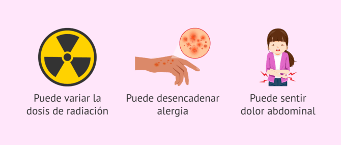 Imagen: Riesgos de la histerosalpingografia