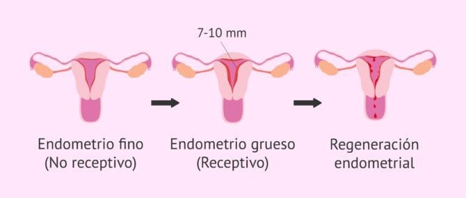 Imagen: Implantación de los embriones