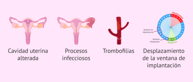 Imagen: Causas de la baja receptividad endometrial