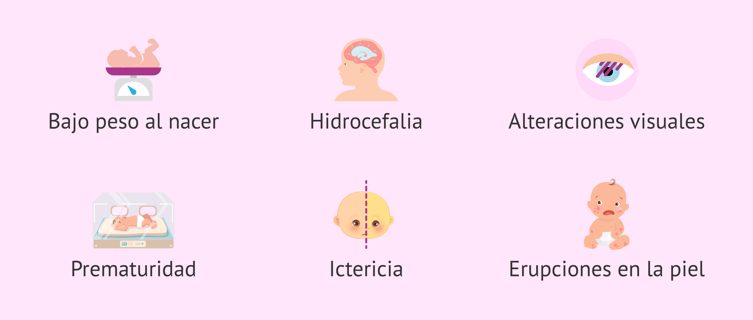 Imagen: Efectos de la toxoplasmosis congénita