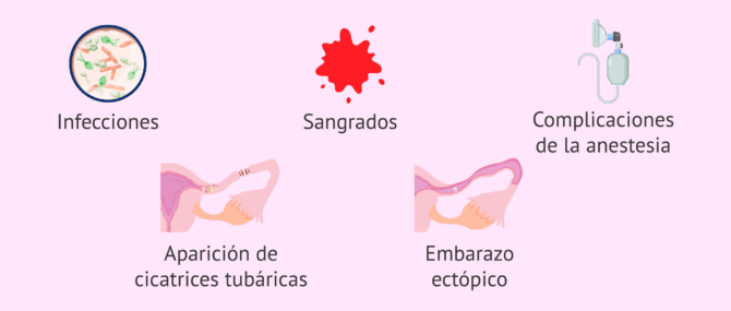 Imagen: Riesgos de la recanalización tubárica