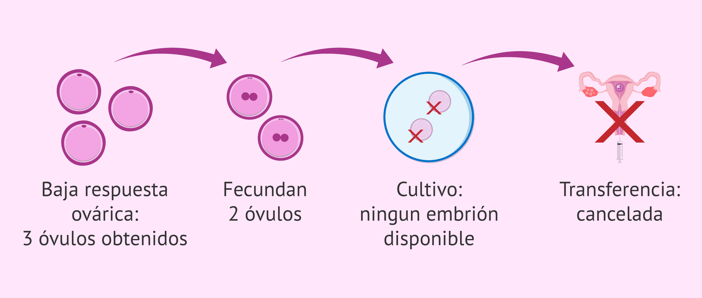 Imagen: Cancelación de la transferencia embrionaria